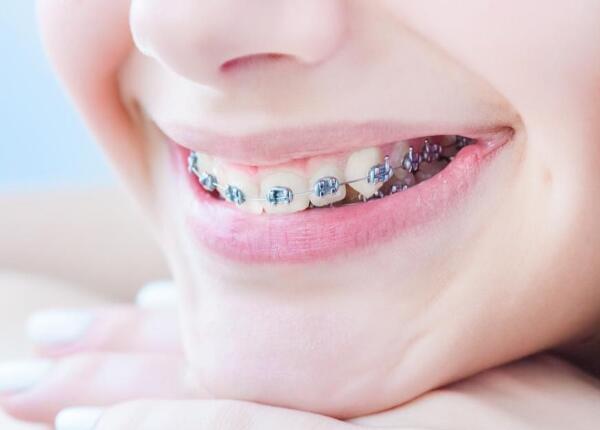 戴了牙套使用電動(dòng)牙刷方法 戴了牙套怎么使用電動(dòng)牙刷